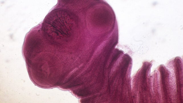Parasites Are Causing Explosive Diarrhea to Surge. Here's How to Avoid The Worst Ones