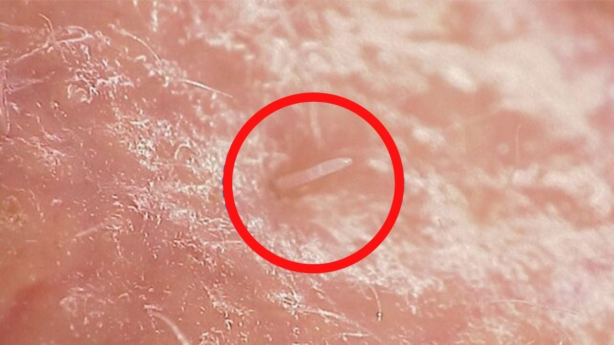 Face mites are gradually merging with the human body