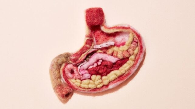 Scientists Found a Hormone That Could Predict Anorexia Relapse Before It Happens