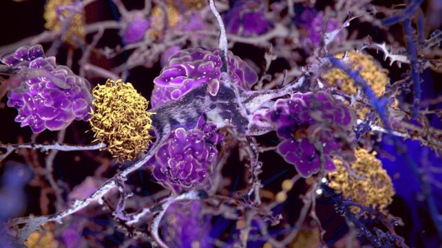 A Human-Safe Drug Reduces Multiple Signs of Alzheimer's in Mice