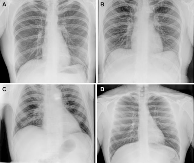 Astronauts Have Spent 65 Years Without X-Rays. That's Finally Changing.