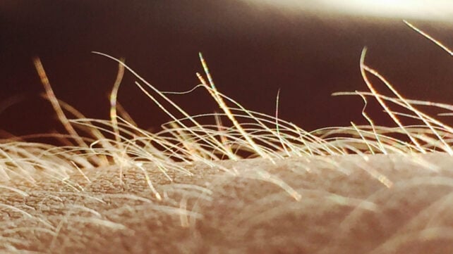 Itching May Have Its Own Sensory Organ