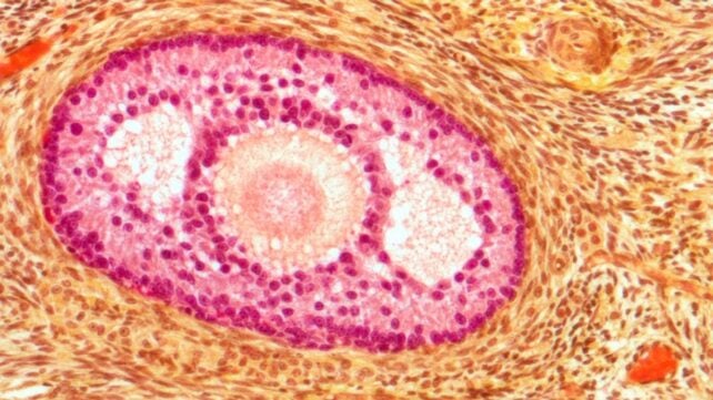 Ovaries Begin Aging Decades Before Menopause &ndash; And The Implications Go Far Beyond Fertility