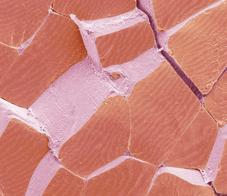 Test Your Eyes: What Is This Microscopic Image of?