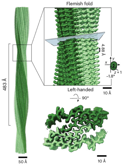 Amyloid-beta filaments