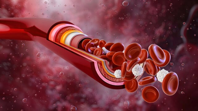 Blood vessel illustration