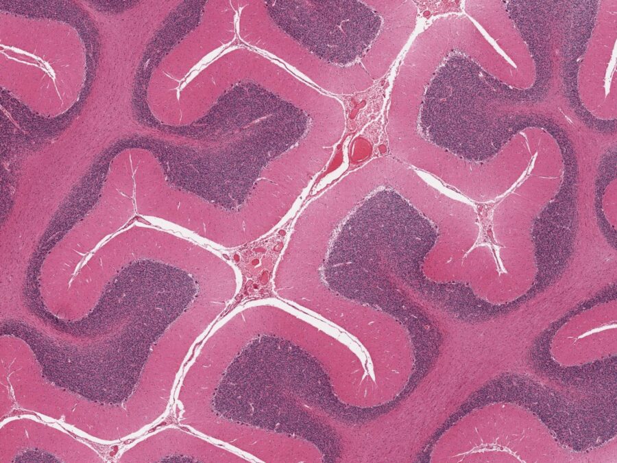 Microscopic view of a stained human cerebellum tissue sample showing its folded tissue architecture.