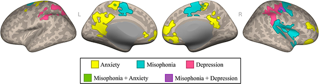 Brain conditions scan