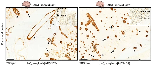 Brain sample scans