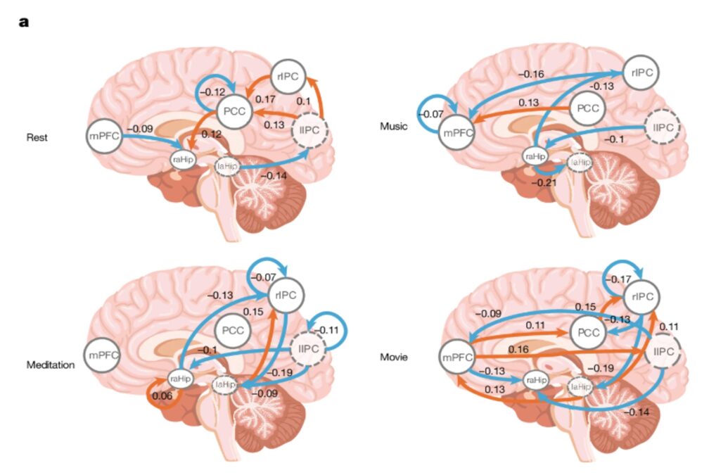 The Largest Psychedelic Brain Study Yet Reveals How Psilocybin Helps People Feel At One With Existence