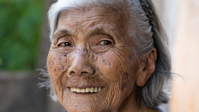 People Who Live Past 100 Have a Surprising Abundance of Cancer-Killing Immune Cells