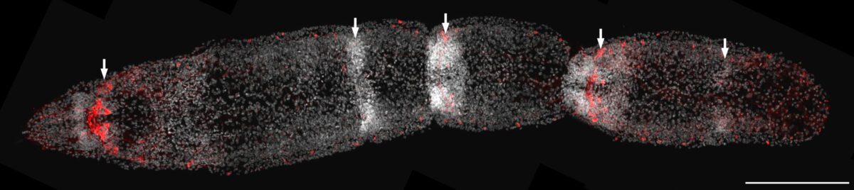 Overfeed This Flatworm And It Turns Into a Chain of Clones