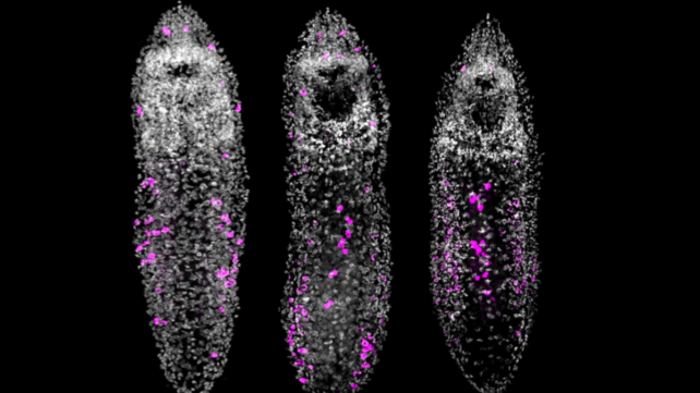 Scientists Overfed a Tiny Worm... And It Started Growing a Chain of Clones