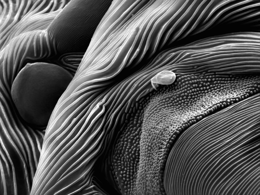 Monday Microscope Mystery: What Is This Black-And-White Structure?