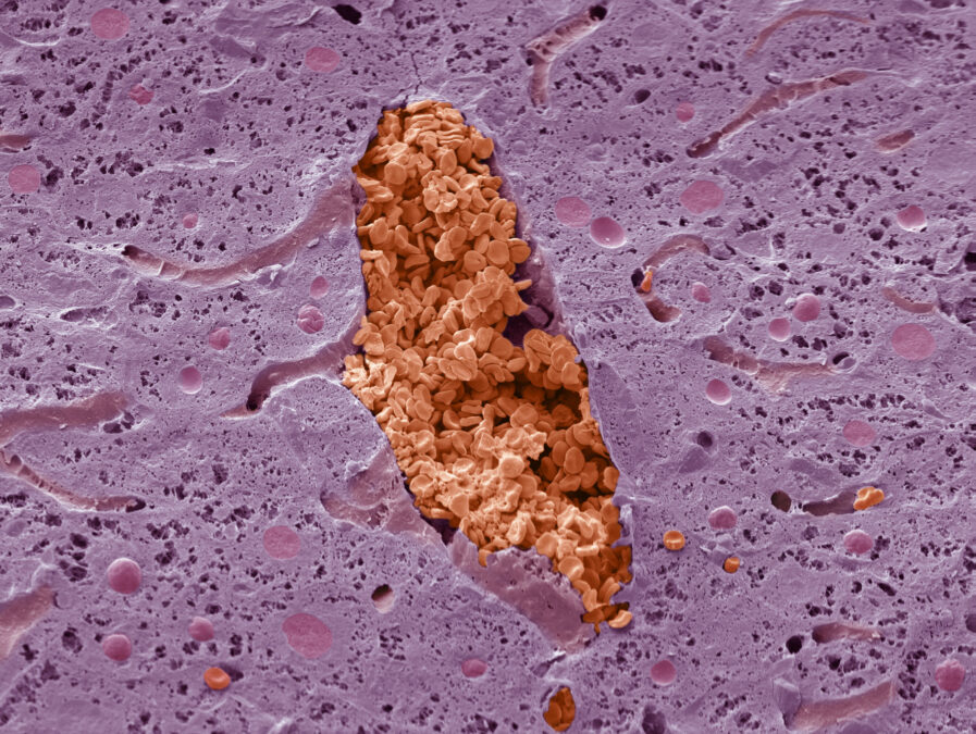 Monday's Microscope Mystery: What Is This Pink And Red Oddity?