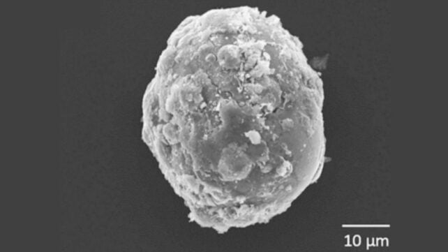 What Do You See? This Week's Monday Microscope Mystery