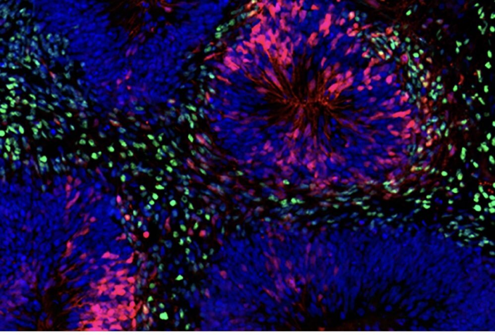 Scientists Built Miniature Brains That Can Experience The Passage Of Time