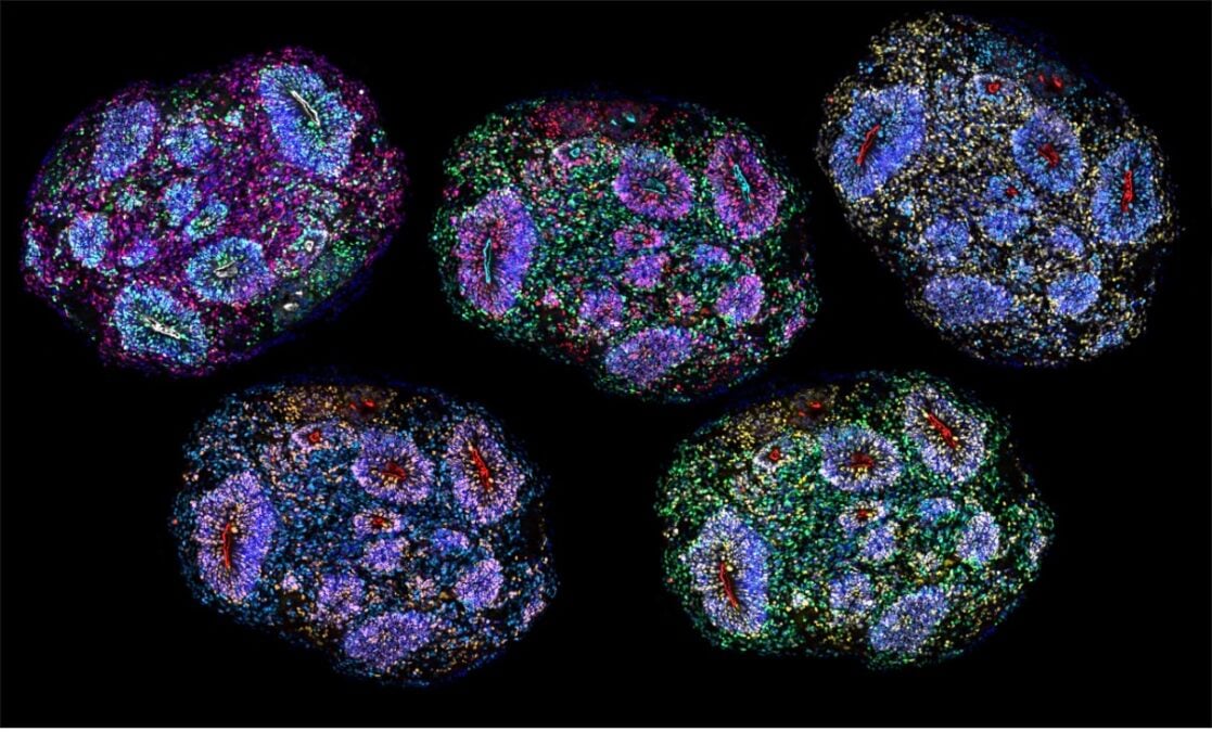 Scientists Built Miniature Brains That Can Experience The Passage Of Time