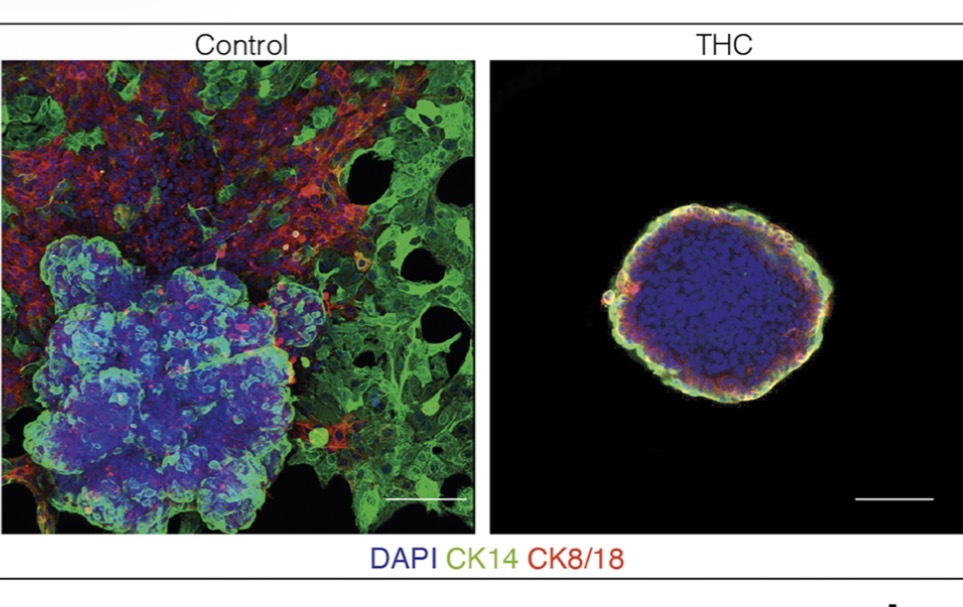 Messing With A Cannabis Receptor Can Make Cancers Easier To Kill, Frankenstein-Like New Research Suggests