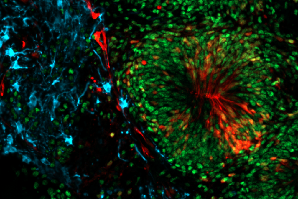 Scientists Built Miniature Brains That Can Experience The Passage Of Time