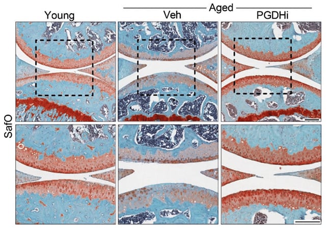 Breakthrough to Restore Aging Joints Could Help Treat Osteoarthritis