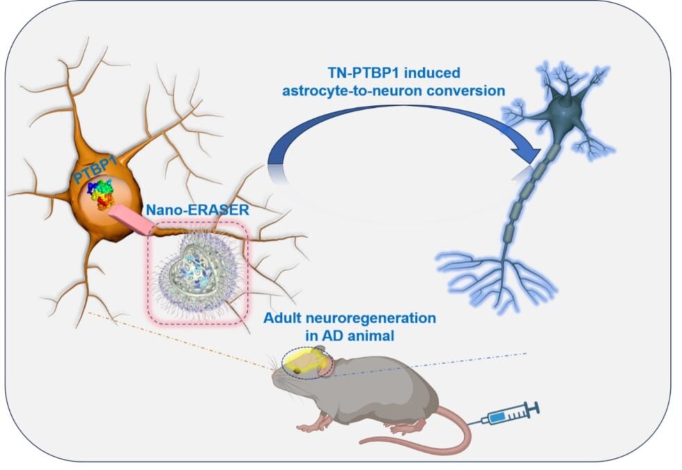 'Nano-ERASER' Reverses Alzheimer's Damage in The Brains of Mice