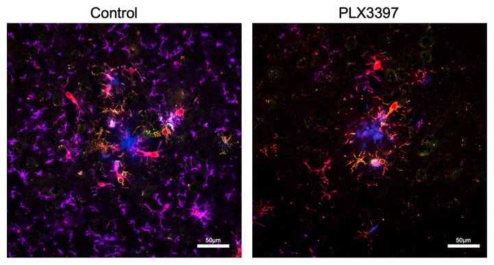 Neuron image analysis