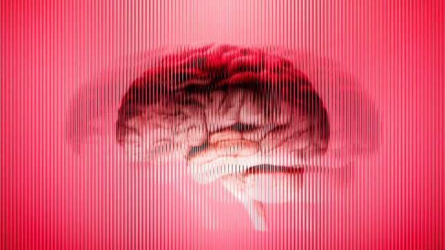 Damaged brain graphic