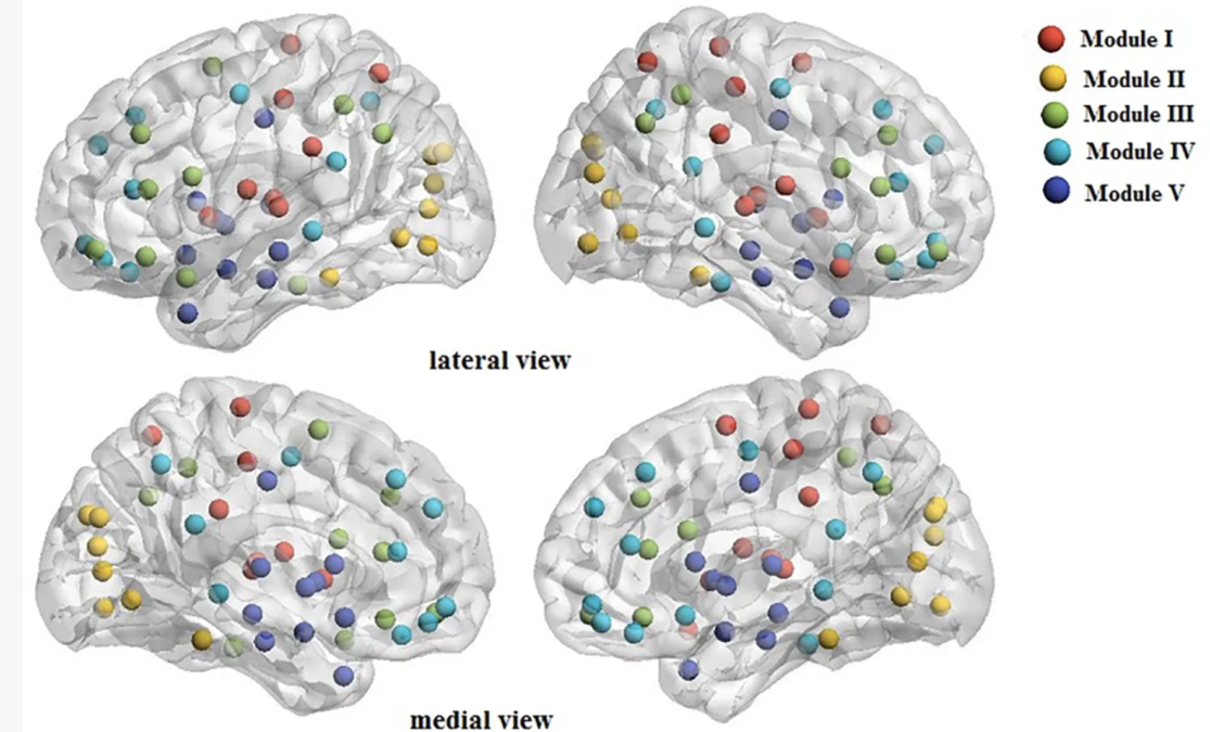 Schizophrenia And Bipolar Brains Show Eerily Similar 'Wiring Faults', Study Finds