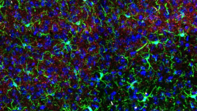 Ketamine Alters Brain Structures &ndash; But Only in One Sex, Study in Mice Finds