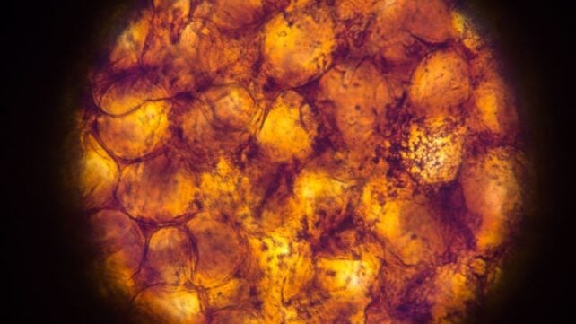 Our Fat Tissue May 'Remember' Obesity, Even After We've Lost Weight