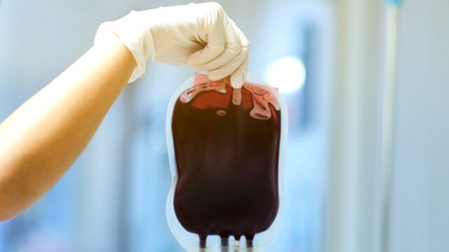Can Alzheimer's Spread Through Blood Transfusions? Here's What We Know.