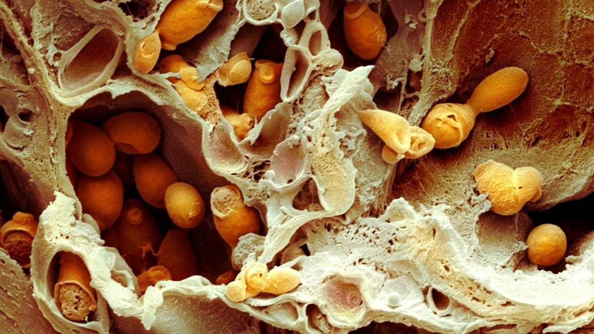 Antibiotikum gladiolin by mohlo posílit léčbu odolných kvasinkových infekcí