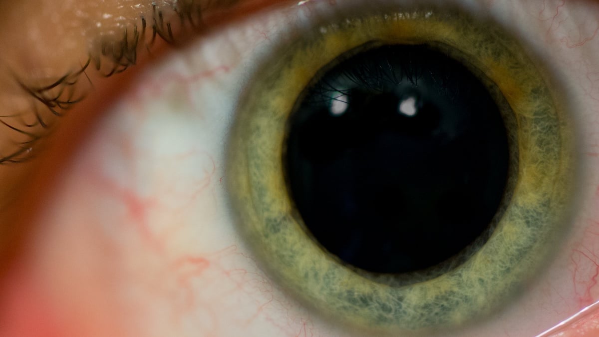 Why Your Pupils Dilate When Surprised: The Brain’s Refresh Mechanism