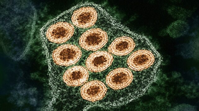 The US Only Diagnoses 7% of Its Human Rabies Cases, Study Finds