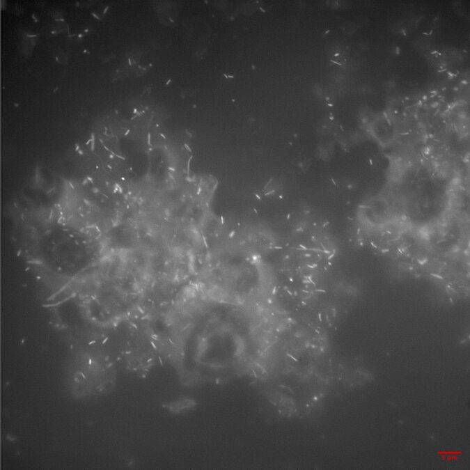 Rock-Eating Fungus Ecosystems Complete With Tardigrades And Worms Are Thriving Deep Within a Gas Shale