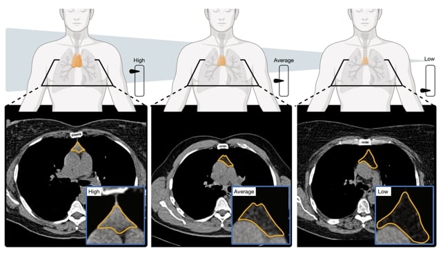 This Organ Plays a Far More Profound Role in Human Longevity Than We Realized, Study Finds