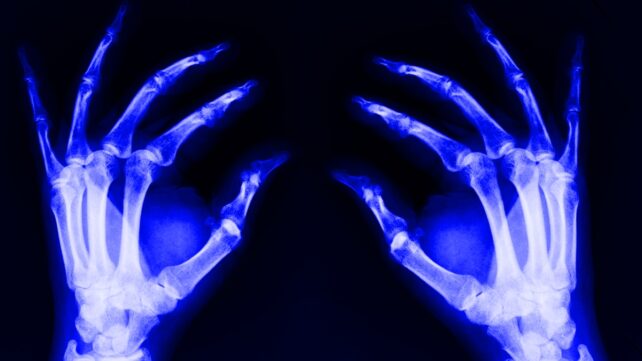 A Hidden Cause of Aging May Spread From Deep Inside Your Bones