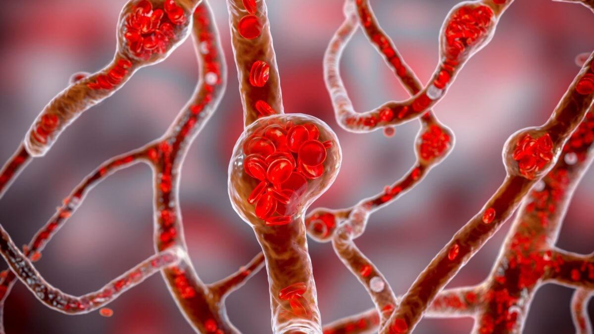 Scientists Might Have Found a New Cause of High Blood Pressure, And a Way to Treat It
