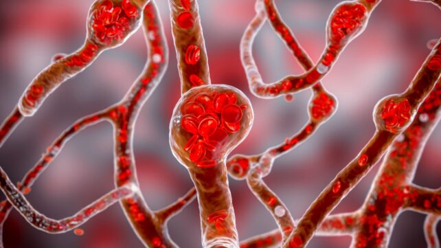 Scientists Might Have Found a New Cause of High Blood Pressure, And a Way to Treat It