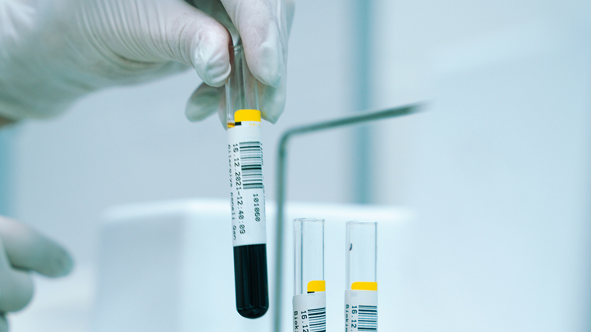 Blood test