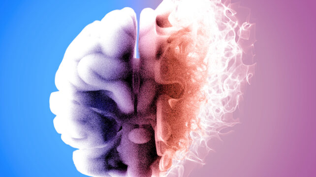 Fading brain