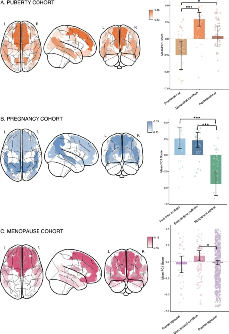Brain Scans Reveal That Menopause May Temporarily Alter Normal Aging