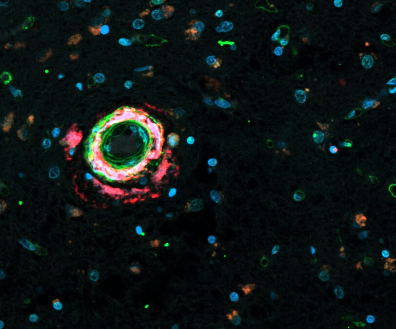 Fluorescence microscopy image showing fibronectin accumulation around a blood vessel in brain tissue.