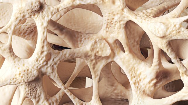Bone structure with osteoporosis - stock photo Realistic bone spongy structure close-up, bone texture affected by osteoporosis, 3d illustration