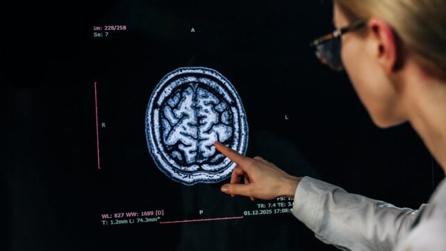 Doctor analyzing human brain MRI image on screen for disease diagnosis