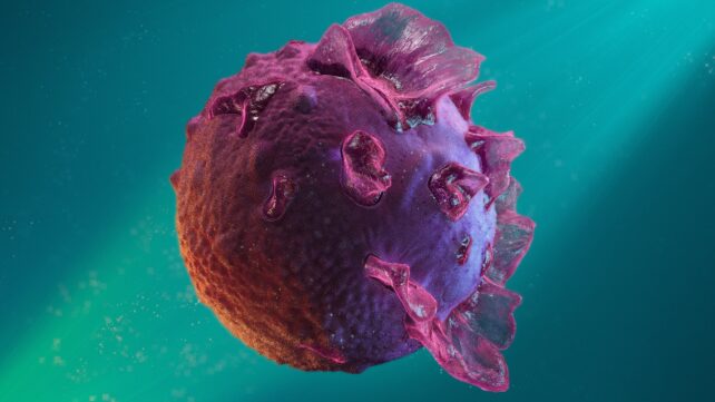 A Common Virus Shows Signs of Reactivating Up to 3 Months Before a Multiple Sclerosis Attack