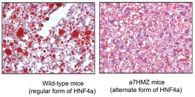 Liver analysis
