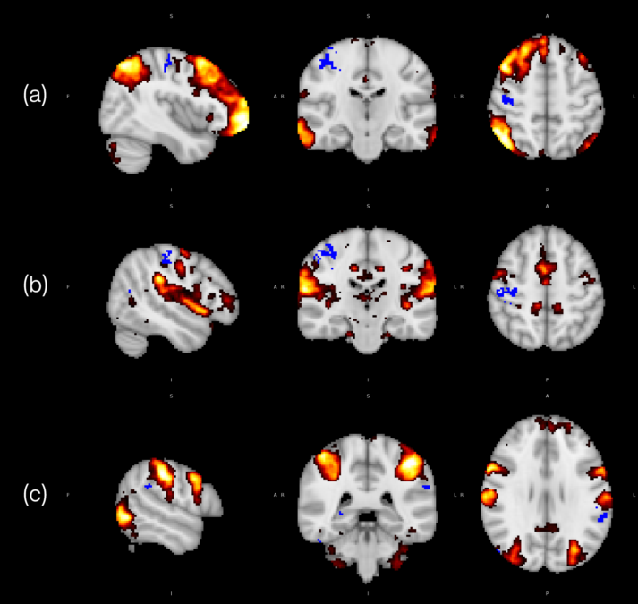 Scientists Had People Eat Tomato Paste For 3 Months. Brain Scans Revealed a Change