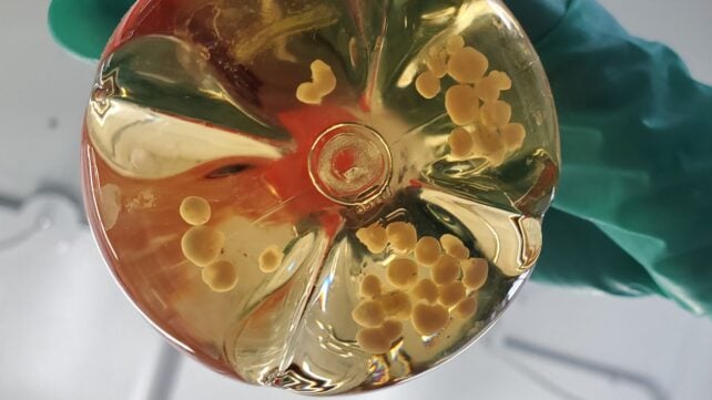 Scientists Connected 3 Human Mini-Brains in a Dish. They Learned Something The Others Couldn't.